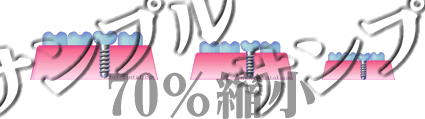 Tv摜